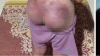 하띤省, 12세 지적 장애 소녀에 고무 채찍으로 체벌.., 절도 혐의